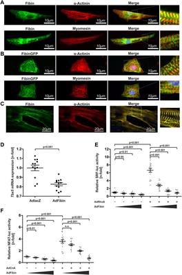 Fibin regulates cardiomyocyte hypertrophy and causes protein-aggregate-associated cardiomyopathy in vivo